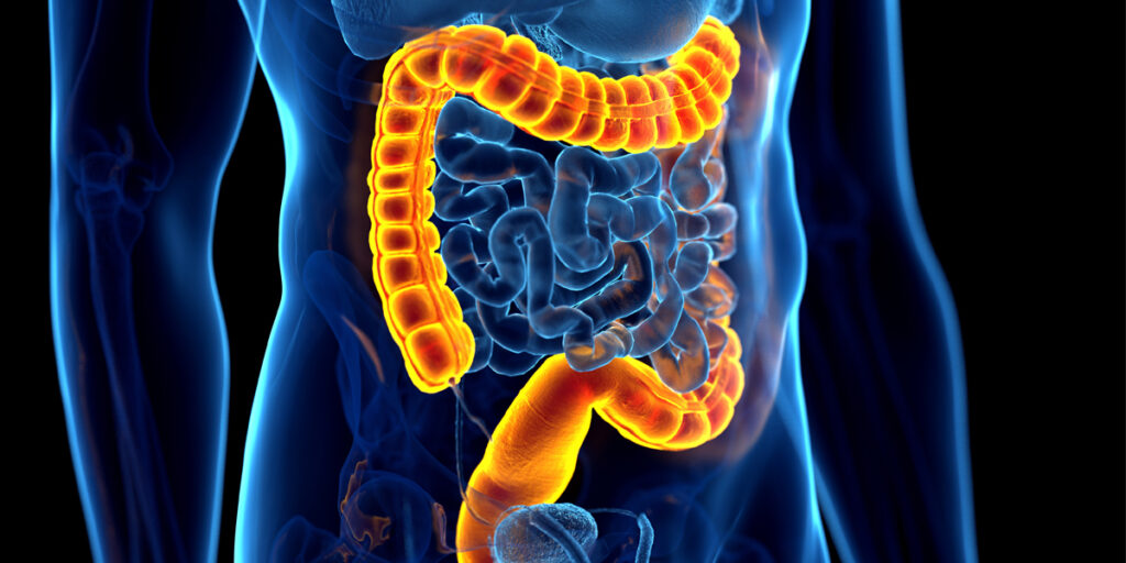 Ibd Installation Virtual IBD Clinic: Updates in Diagnostic, Therapeutic, and Prognostic ...