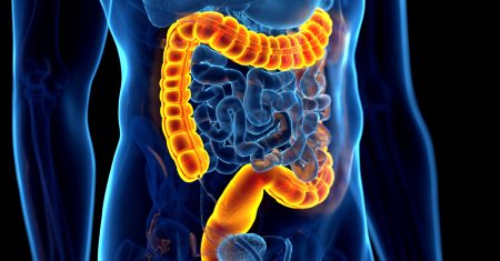 05-22-639-VL-002-Virtual IBD Clinic-WEB-14035