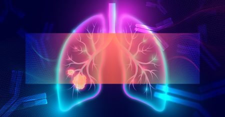 78-21-428-VL-003 NSCLC Act2 1200x600