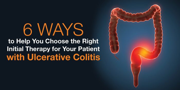 BLOG IMAGE_Ulcerative Colitis