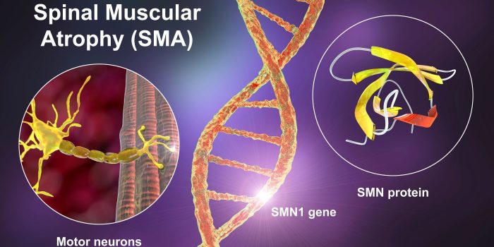 blog 1 sma spinal muscular atrophy (SMA) New treatments for SMA